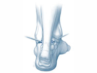 tratamentos-artroscopia