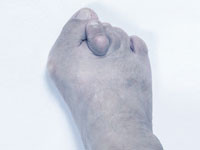 tratamentos-deformidade