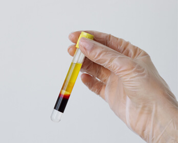 prp3
